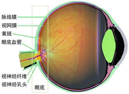 激光眼底病 