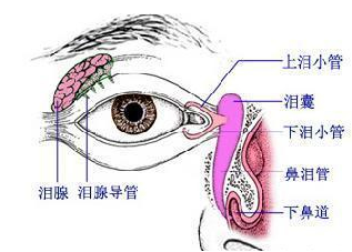 泪道阻塞的病因是什么？表现是什么？