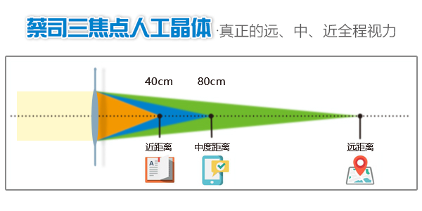 普瑞眼科重新定义高端白内障手术