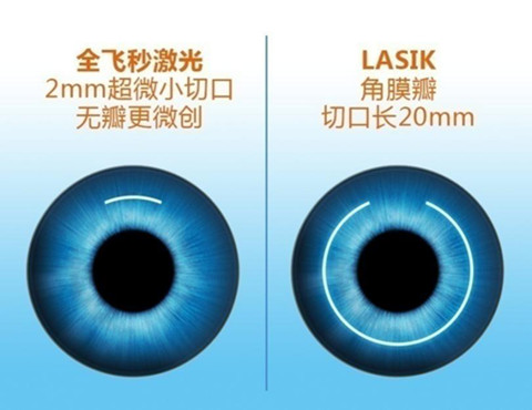 当兵近视眼怎么办? 别让视力成为绊脚石