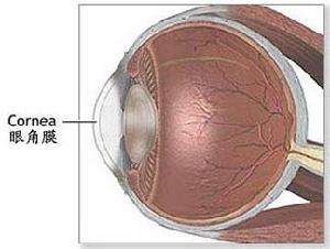 角膜炎症状及方法