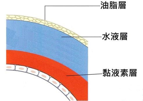 干眼症病因